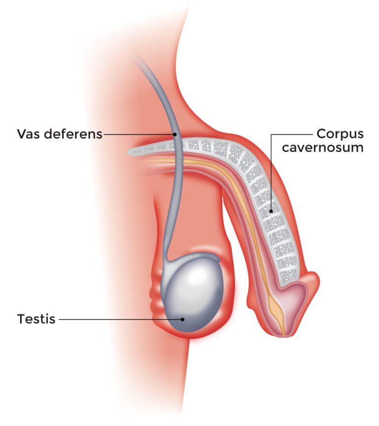 Erectile Dysfunction and Vasectomy.
