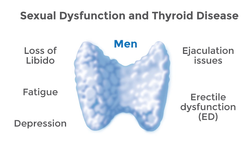 Erectile dysfunction and thyroid disease.