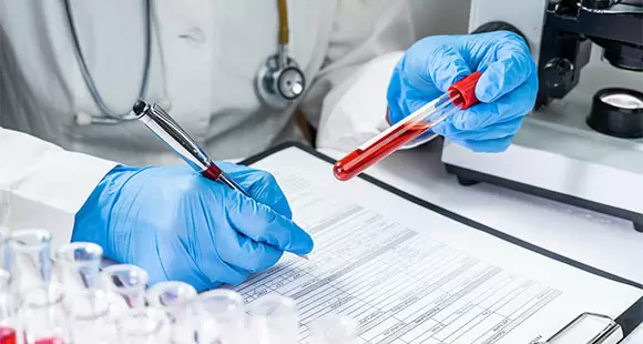 Blood tests