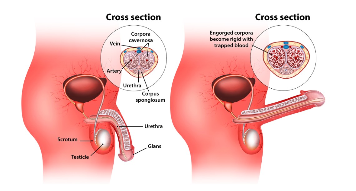 Erect and flaccid penis
