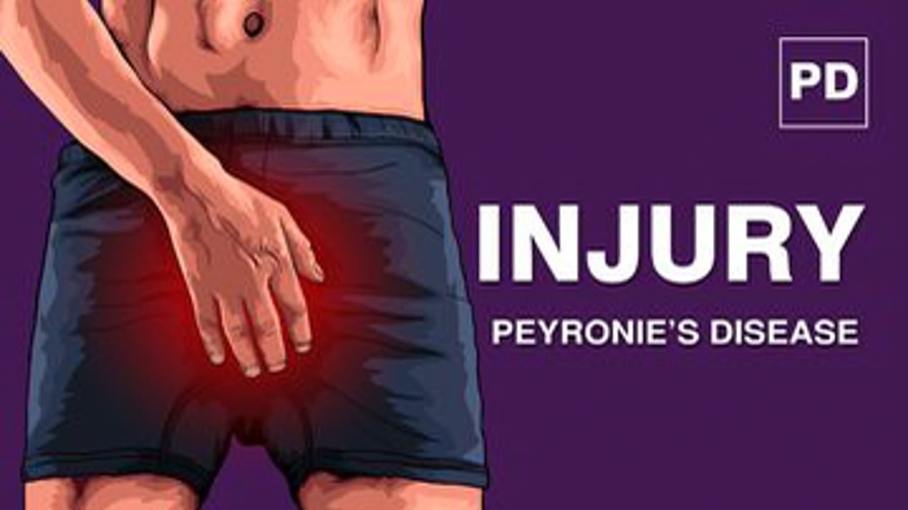 Injury and Peyronie’s Disease