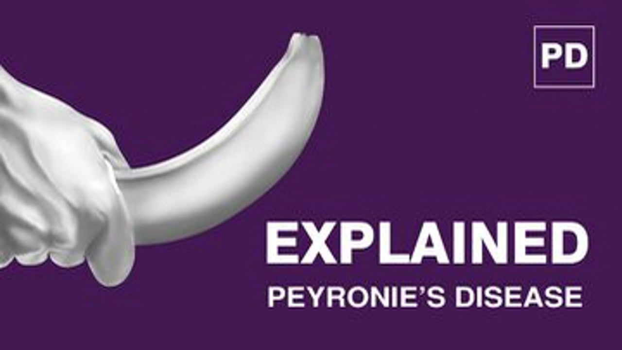 Peyronie’s Disease Explained