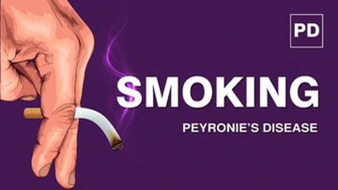 Smoking and Peyronie’s Disease