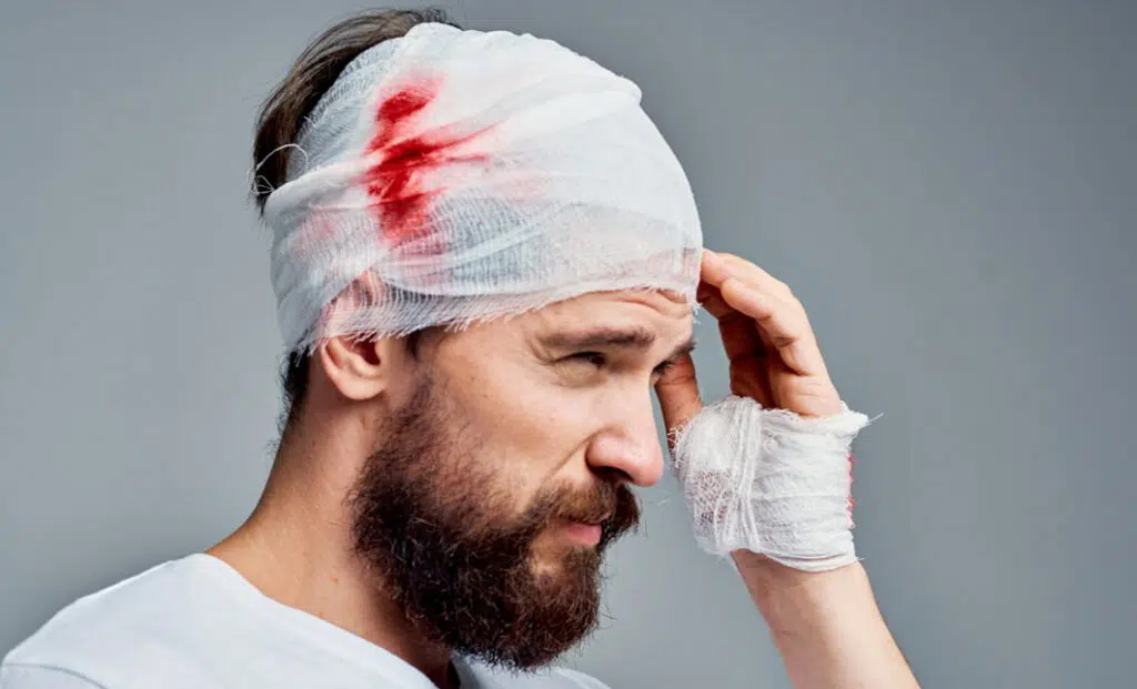 Erectile dysfunction and brain injury