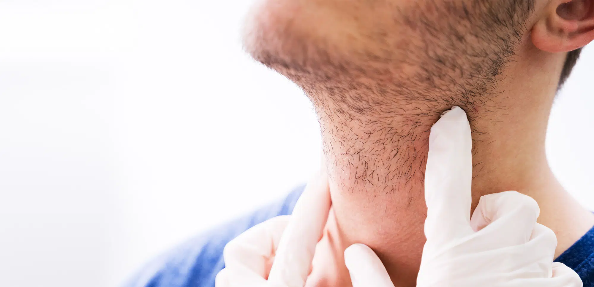 Thyroid Disease & Erectile Dysfunction – Hormonal Impact Explained